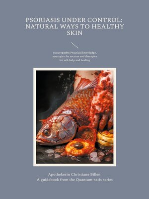 cover image of Psoriasis under control--Natural ways to healthy skin